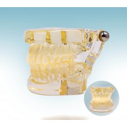 مولاژ دندان انسان کد 003